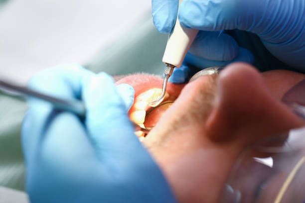 Best Emergency Cosmetic Dentistry (e.g., broken veneers) in Sewanee, TN